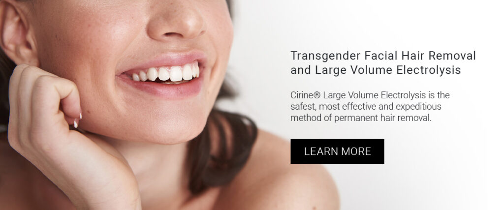 Transgender Facial Hair Removal and Large Volume Electrolysis