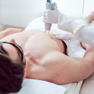 laser hair removal in chicago