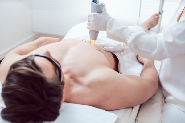 laser hair removal in chicago
