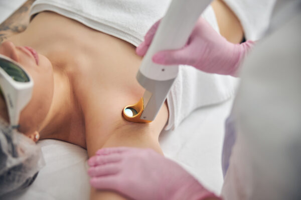 laser hair removal chicago