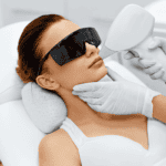 Woman getting laser hair removal to her upper lip